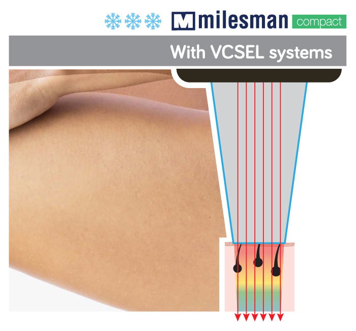 VCSEL-1