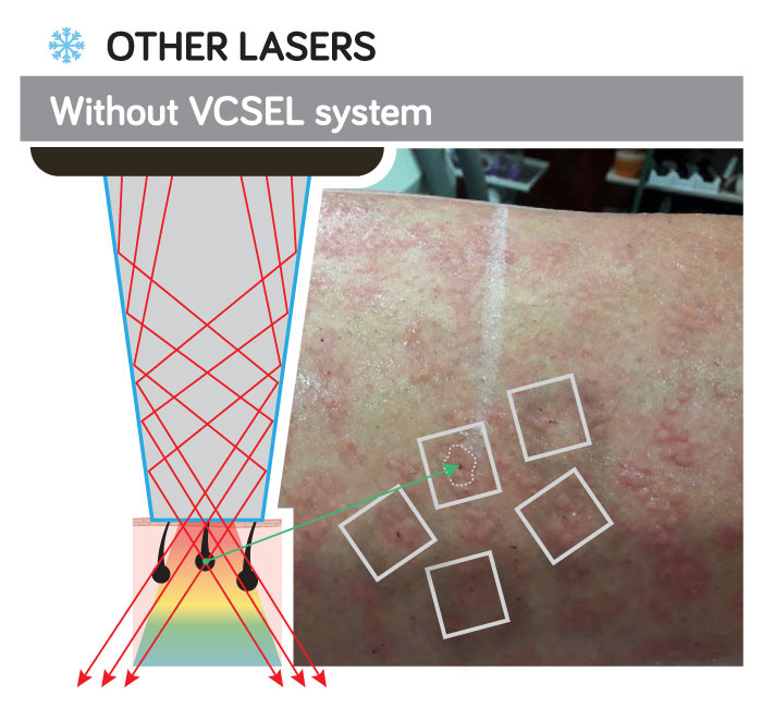 VCSEL-2